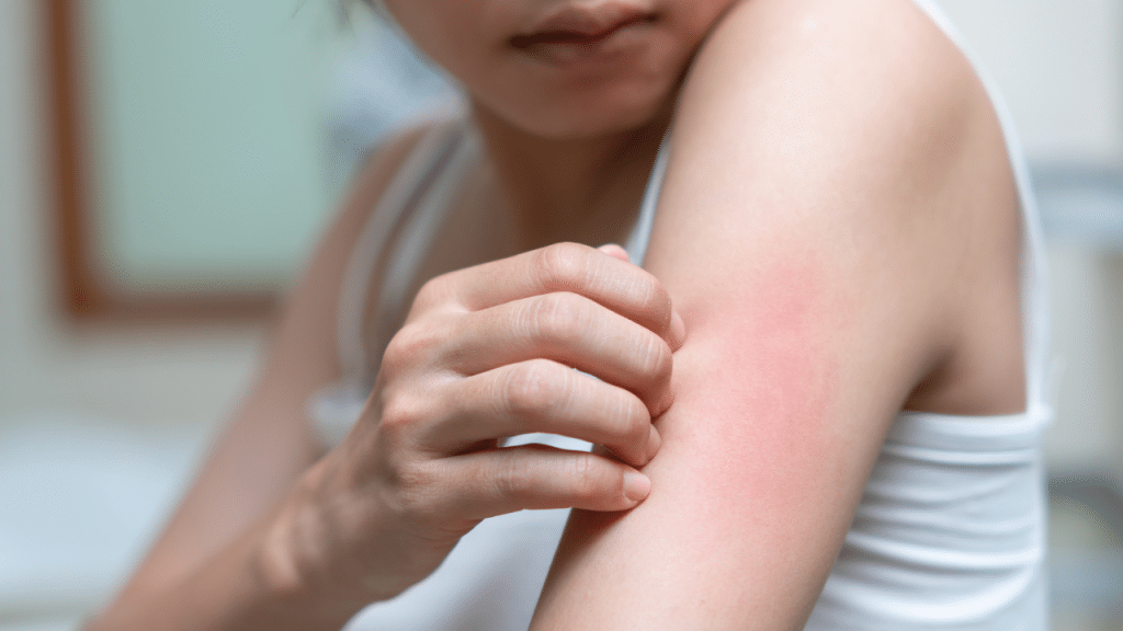 skin reaction towards fragrance